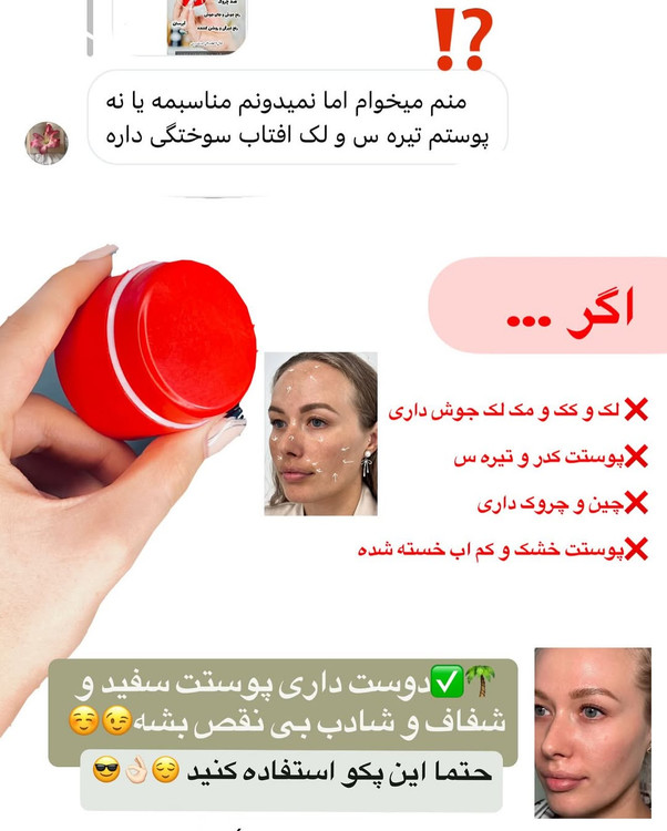 لک و کک مک / رفع چین و چروک